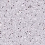 Atlas Antibodies Anti-PRPF6 Antibody