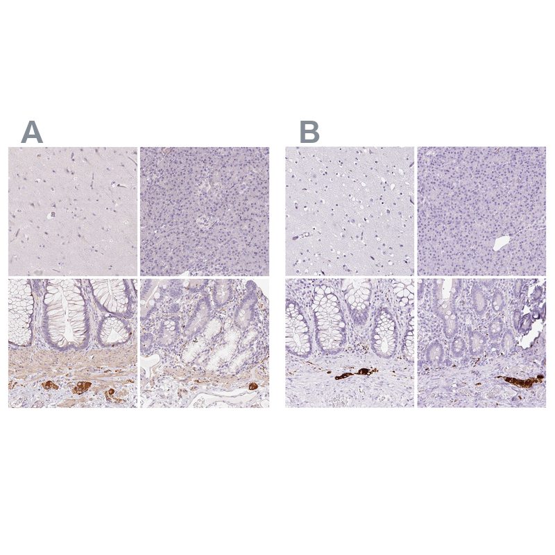 Atlas Antibodies Anti-PRPH Antibody