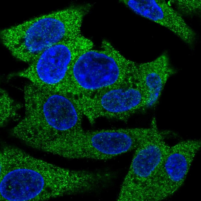Atlas Antibodies Anti-PRPSAP1 Antibody