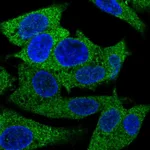 Atlas Antibodies Anti-PRPSAP1 Antibody