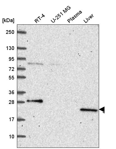 Atlas Antibodies Anti-PRPS2 Antibody