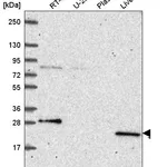 Atlas Antibodies Anti-PRPS2 Antibody