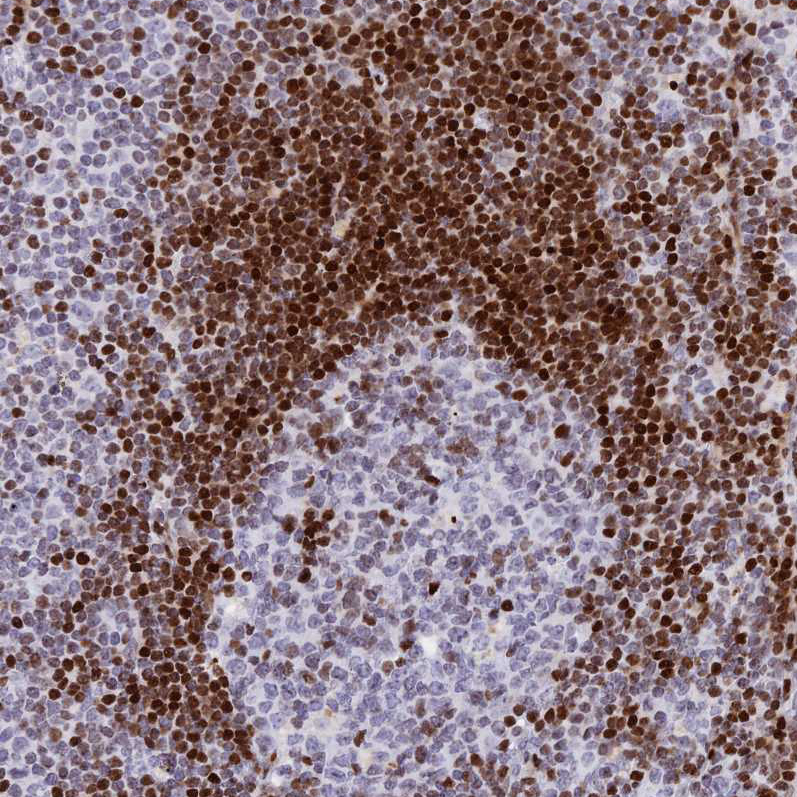 Atlas Antibodies Anti-PRPS1 Antibody