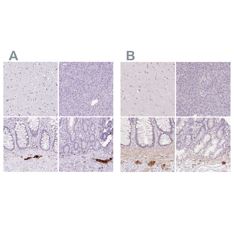 Atlas Antibodies Anti-PRPH Antibody