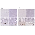 Atlas Antibodies Anti-PRPH Antibody