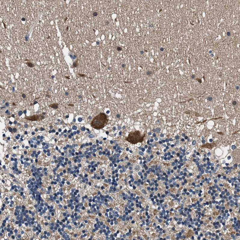 Atlas Antibodies Anti-PRPSAP2 Antibody