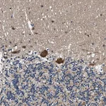 Atlas Antibodies Anti-PRPSAP2 Antibody
