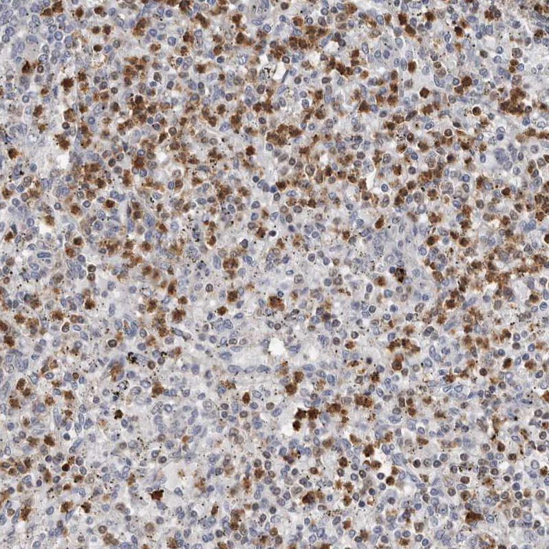 Atlas Antibodies Anti-PRR12 Antibody
