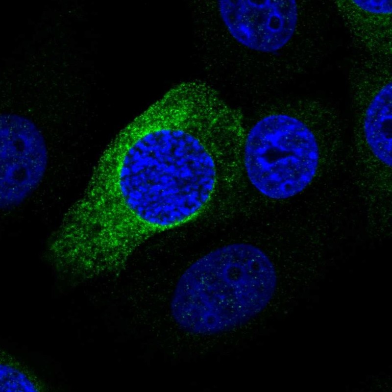 Atlas Antibodies Anti-PRR11 Antibody