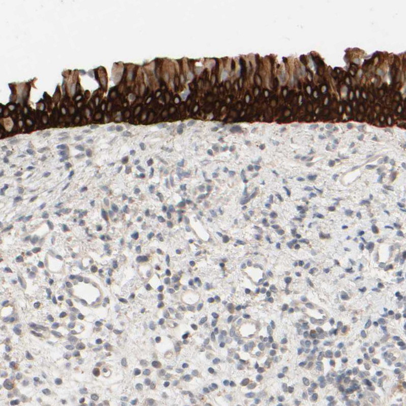 Atlas Antibodies Anti-PRR11 Antibody