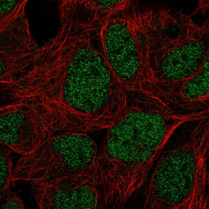 Atlas Antibodies Anti-PRR14 Antibody