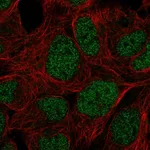 Atlas Antibodies Anti-PRR14 Antibody