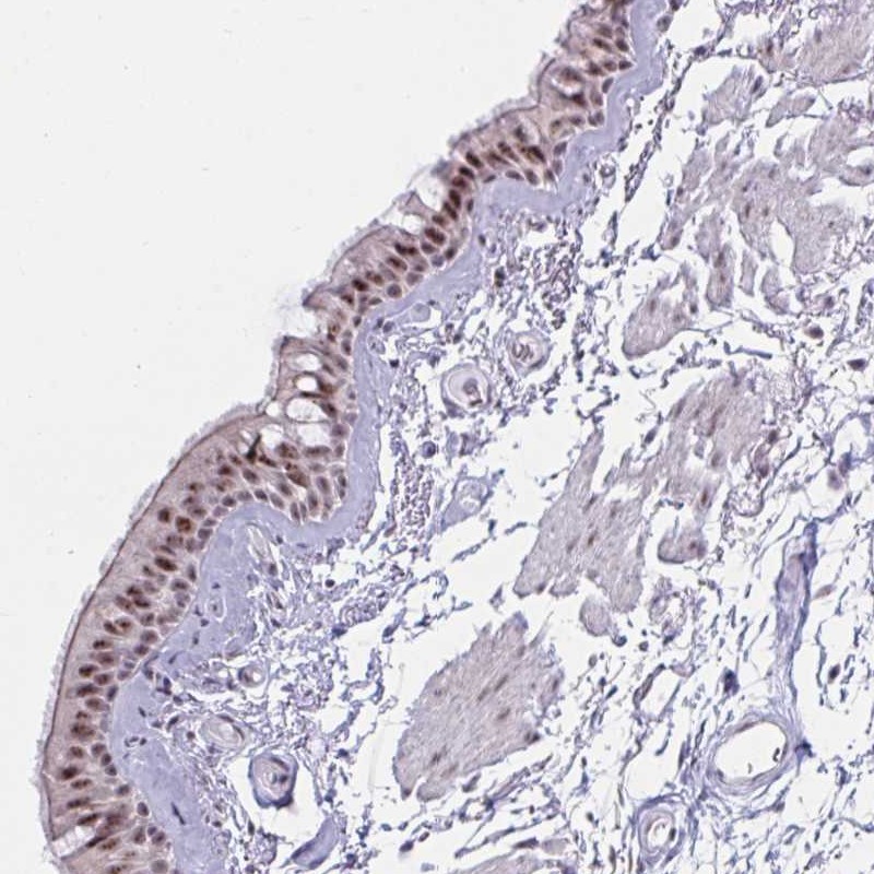 Atlas Antibodies Anti-PRR14 Antibody