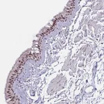 Atlas Antibodies Anti-PRR14 Antibody