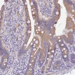 Atlas Antibodies Anti-PRR13 Antibody