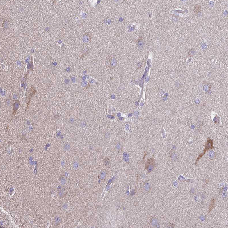 Atlas Antibodies Anti-PRR14L Antibody