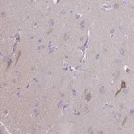 Atlas Antibodies Anti-PRR14L Antibody