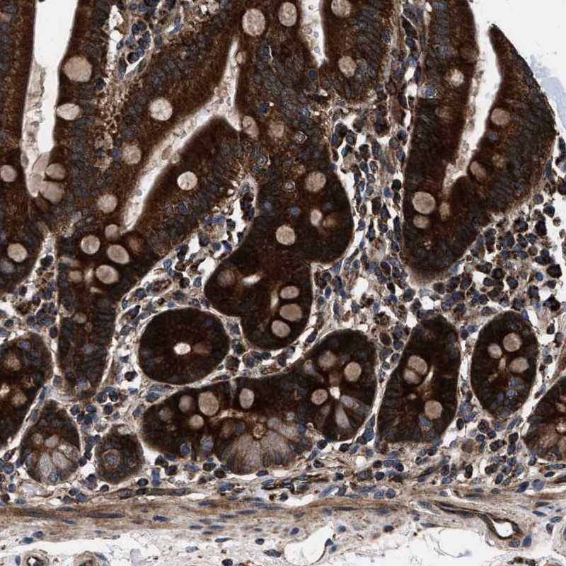 Atlas Antibodies Anti-PRR15L Antibody
