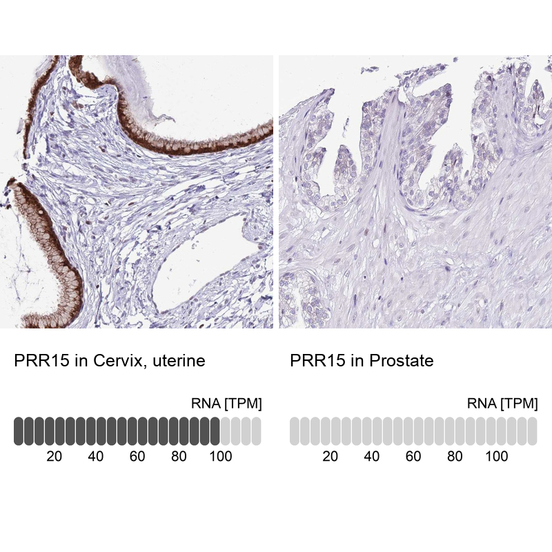 Atlas Antibodies Anti-PRR15 Antibody