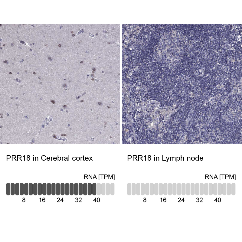 Atlas Antibodies Anti-PRR18 Antibody