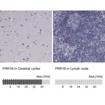 Atlas Antibodies Anti-PRR18 Antibody