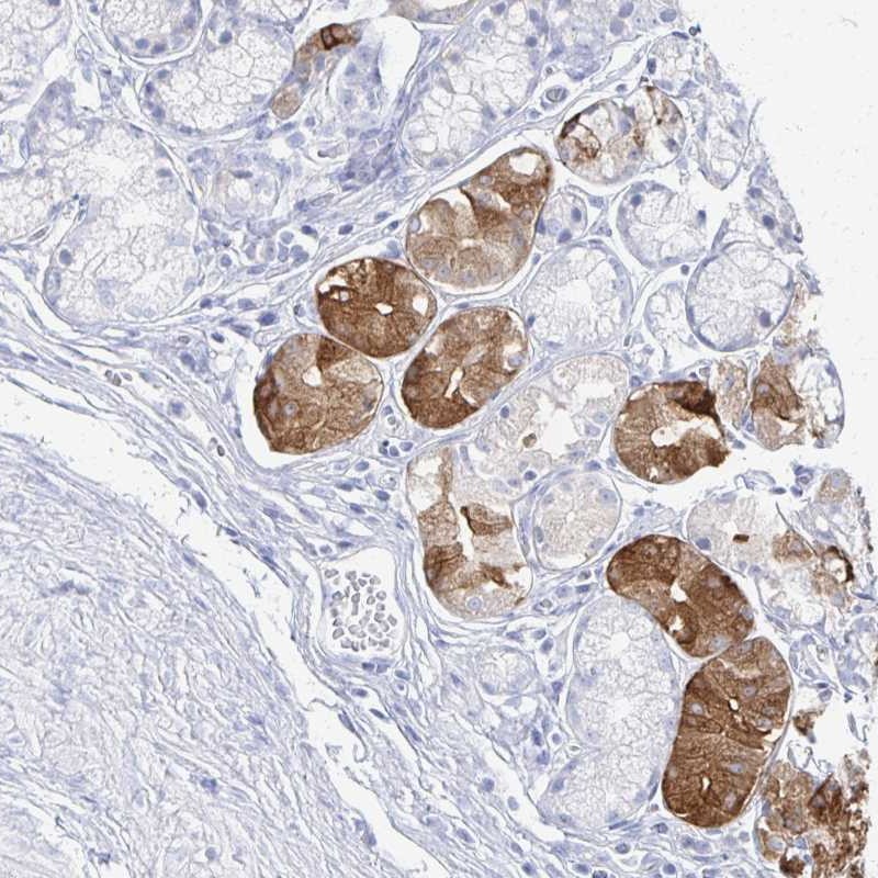 Atlas Antibodies Anti-PRR20A Antibody