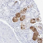 Atlas Antibodies Anti-PRR20A Antibody