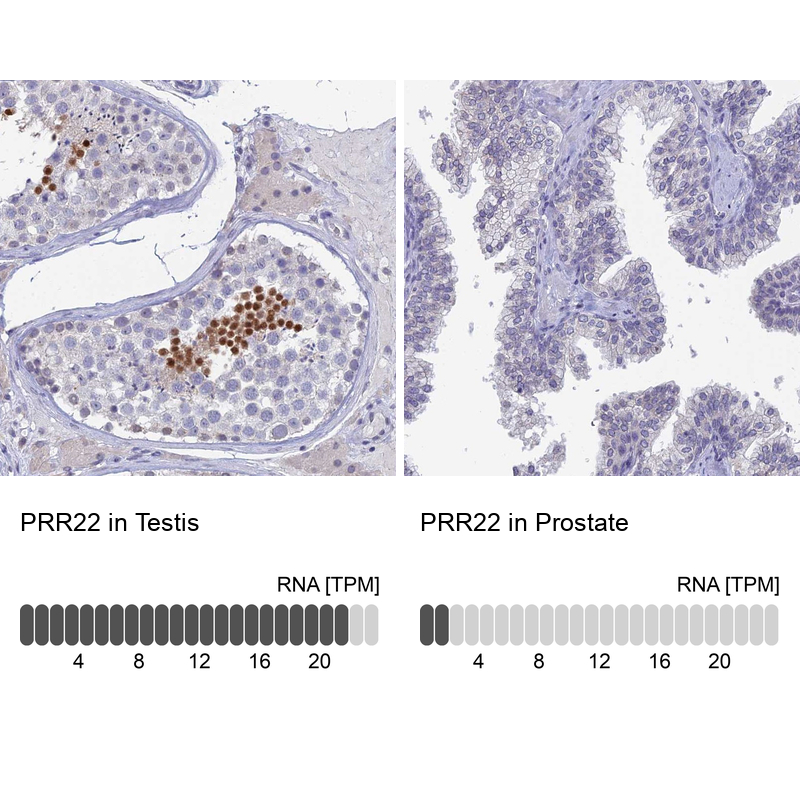Atlas Antibodies Anti-PRR22 Antibody