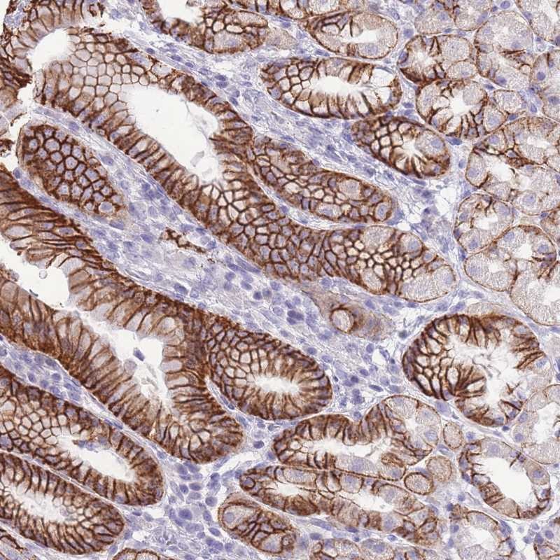 Atlas Antibodies Anti-PRR23A Antibody