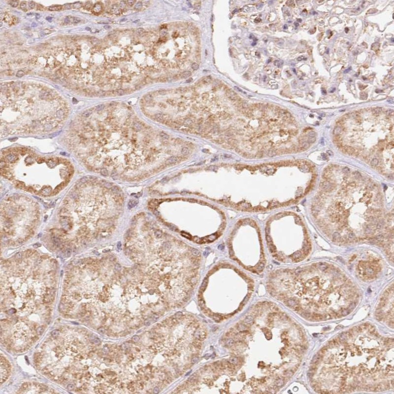 Atlas Antibodies Anti-PRR26 Antibody