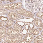 Atlas Antibodies Anti-PRR26 Antibody