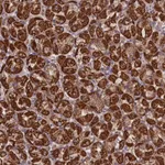 Atlas Antibodies Anti-PRR25 Antibody