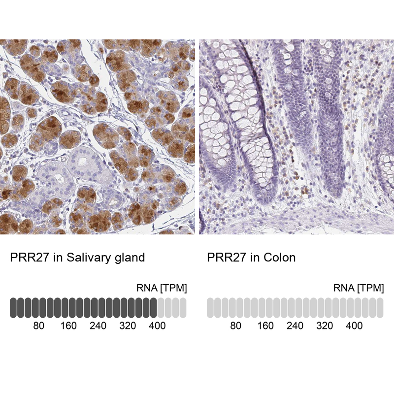 Atlas Antibodies Anti-PRR27 Antibody