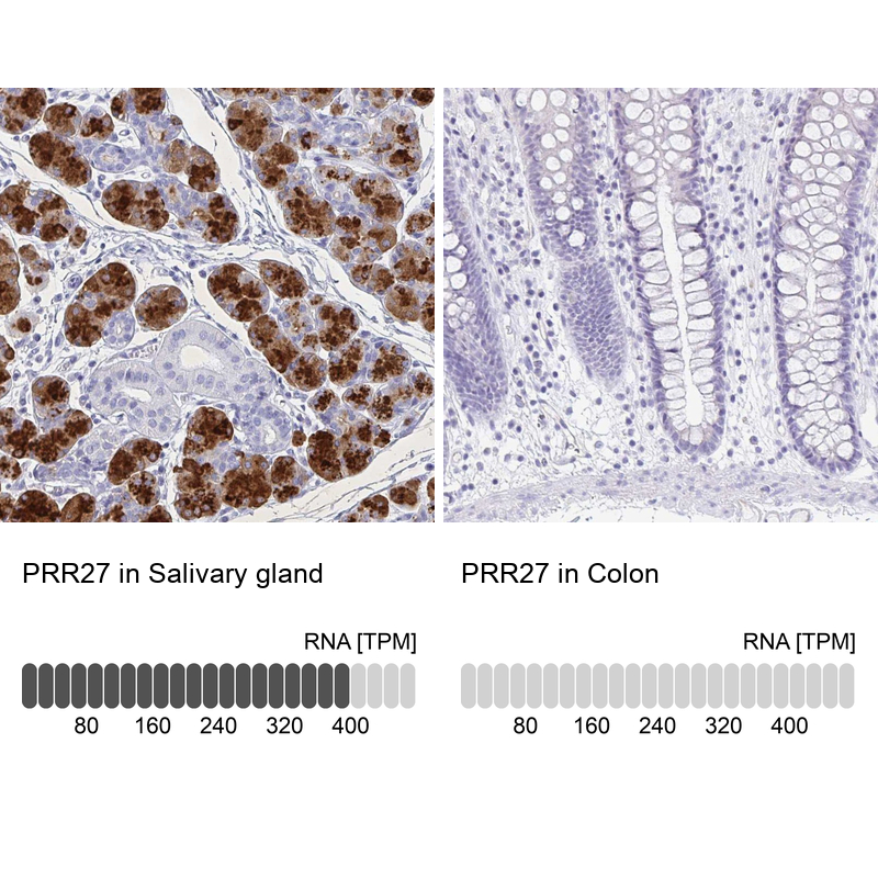 Atlas Antibodies Anti-PRR27 Antibody