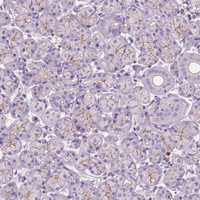 Atlas Antibodies Anti-PRR35 Antibody