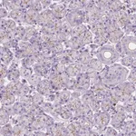 Atlas Antibodies Anti-PRR35 Antibody