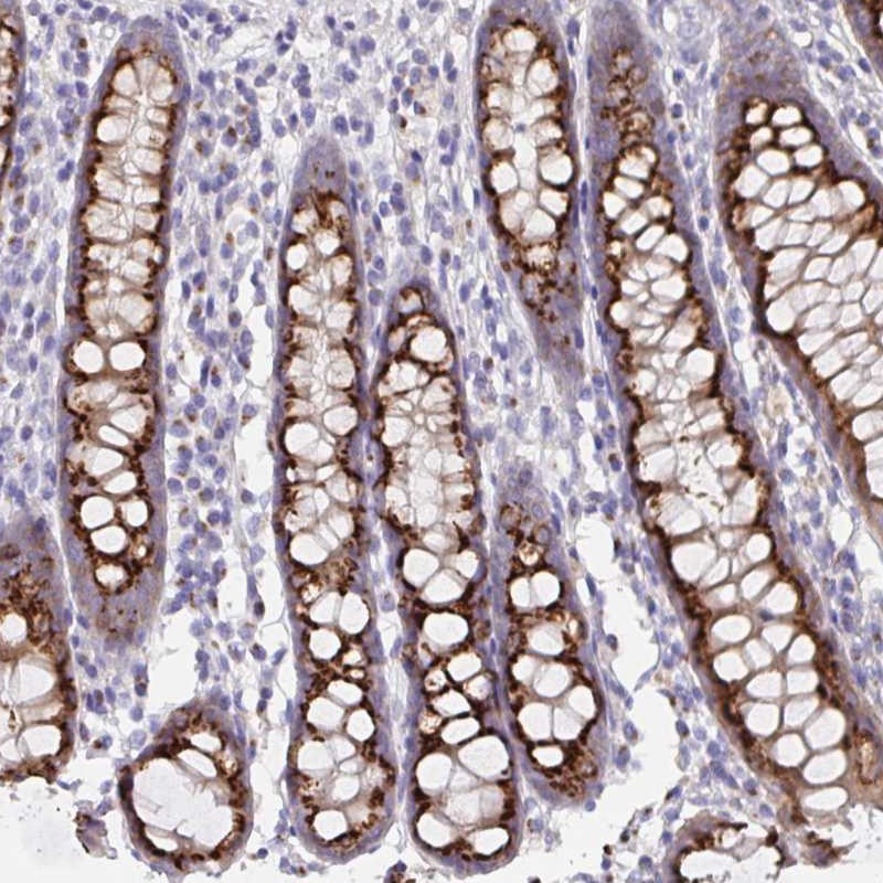 Atlas Antibodies Anti-PRR36 Antibody