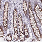 Atlas Antibodies Anti-PRR36 Antibody