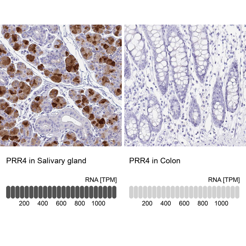 Atlas Antibodies Anti-PRR4 Antibody