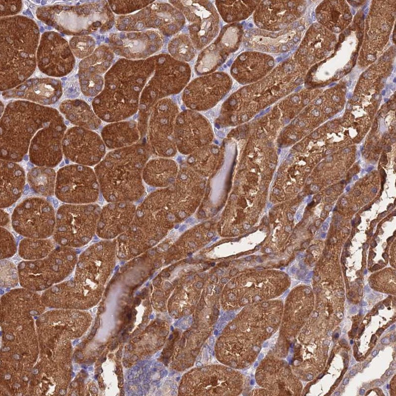 Atlas Antibodies Anti-PRR32 Antibody