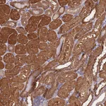 Atlas Antibodies Anti-PRR32 Antibody