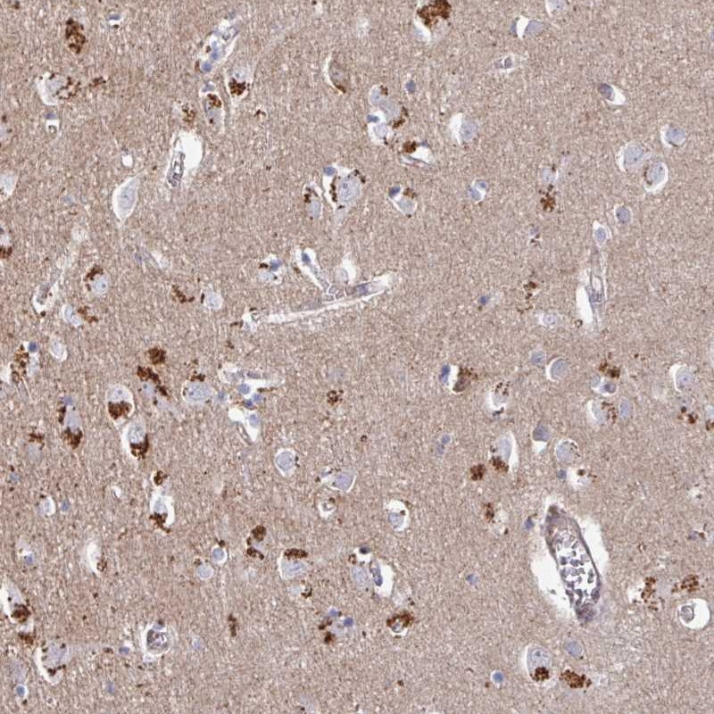Atlas Antibodies Anti-PRR5 Antibody