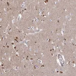 Atlas Antibodies Anti-PRR5 Antibody