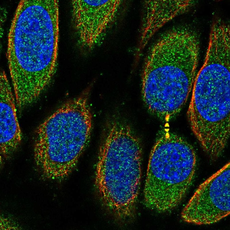 Atlas Antibodies Anti-PRR5L Antibody