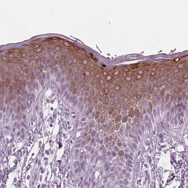 Atlas Antibodies Anti-PRR9 Antibody