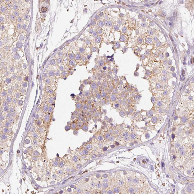 Atlas Antibodies Anti-PRRC2A Antibody