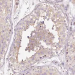 Atlas Antibodies Anti-PRRC2A Antibody