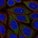 Atlas Antibodies Anti-PRRC2B Antibody