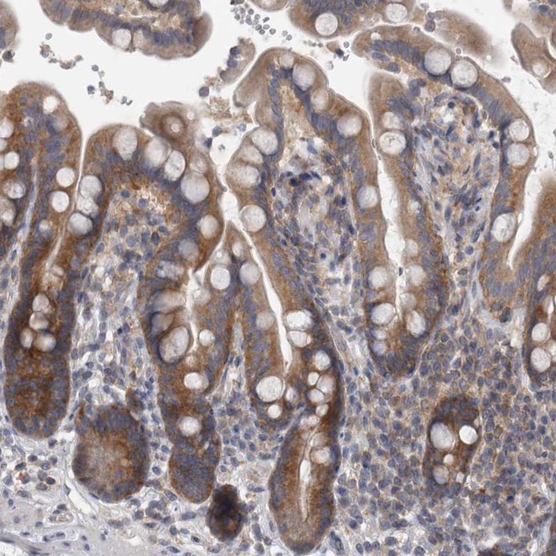 Atlas Antibodies Anti-PRRC2C Antibody