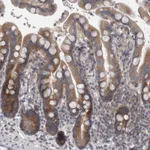 Atlas Antibodies Anti-PRRC2C Antibody